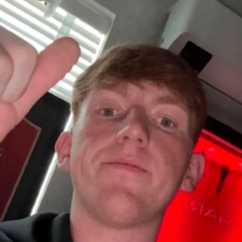 I'm a Celeb's Angry Ginge Reveals Devastating House Fire Killed Three Pets