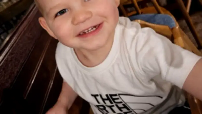 Parents Raise Over £6,000 After Son's Burns Injury