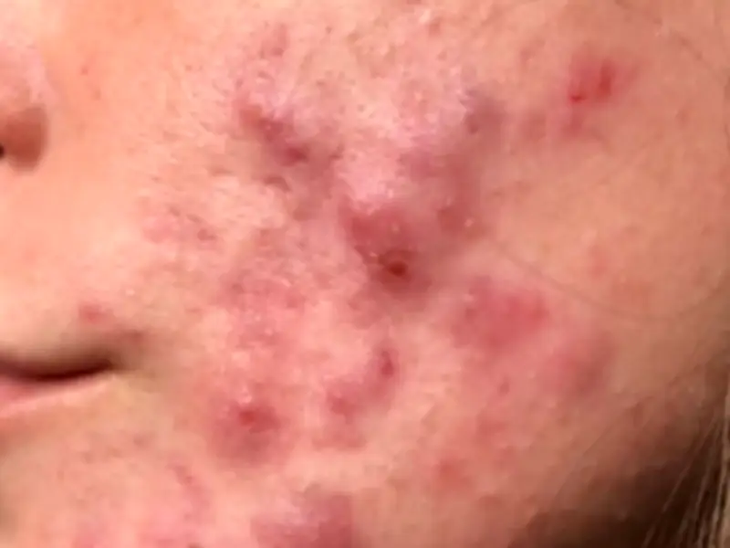 Woman 'Wouldn't Leave House' Before £16 Serum 'Got My Confidence Back'