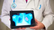 AI Rollout Across NHS to Speed Up Cancer Diagnoses by 2029