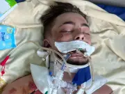 Birmingham dad in Thailand hospital shows small improvements as family feel 'let down' by UK Government