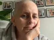 Wolverhampton mum ignored 'odd' bruise, then diagnosed with incurable cancer