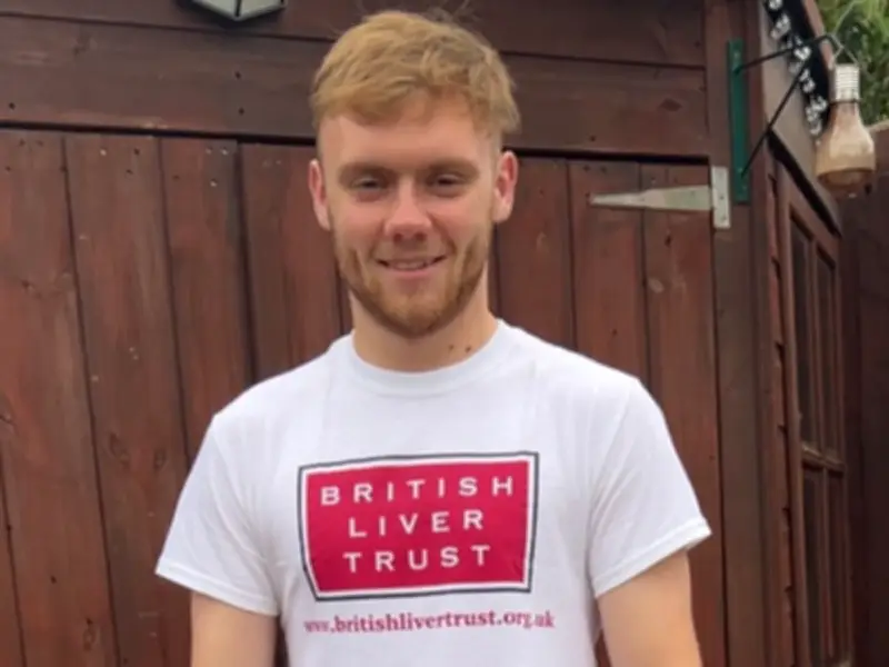 Black Country Man, 22, Shocked by Rare Liver Disease Diagnosis